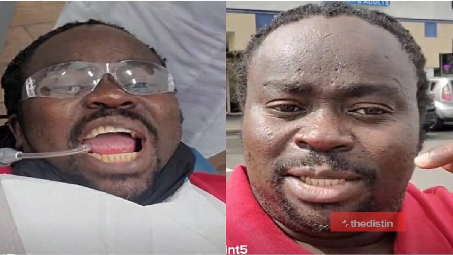 Man Proves Ghanaians Thinking His Teeth Is Bad, Wrong After Visiting The Dentist
