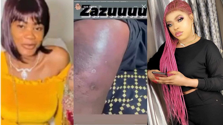 Watch video: Bobrisky former P.A releases video of the alleged rotten buttocks of the cross-dresser