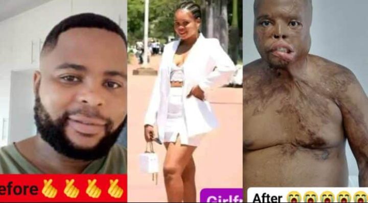 Odo mu nsem!! Lady pours acid on her boyfriend for allegedly cheating on her